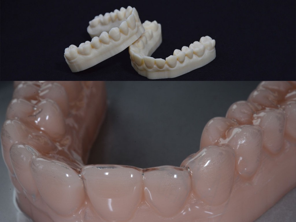 3D-printed-dental-model-thermoforming-resin-model-300